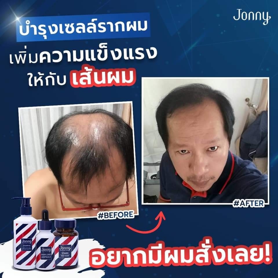 👍เลือก JONNY ใช้ 