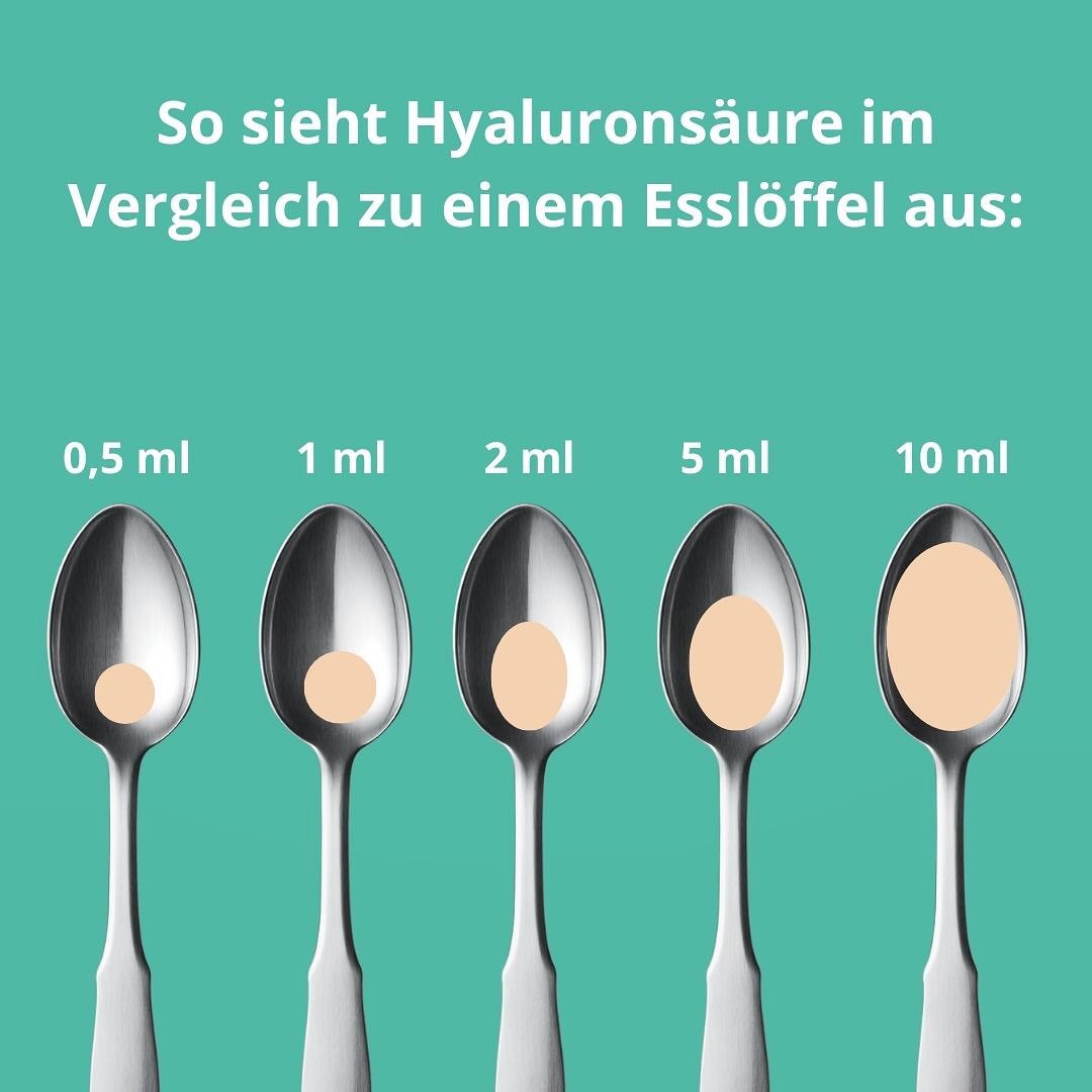 Oft kann man sich schwer vorstellen, wie viel 1 ml Hyaluronsäure überhaupt ist. Um Euch einen besseren Eindruck zu geben, haben wir hier verschiedene Mengen Hyaluronsäure zum Vergleich auf einem Esslö