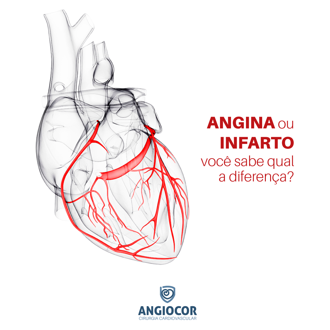Angiocor Caçador - ️ A angina e o infarto provocam uma dor no peito com ...