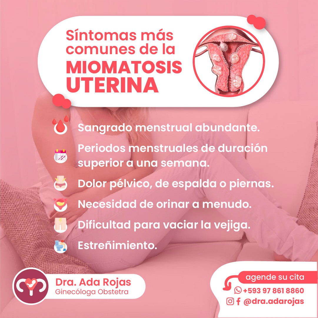 Dra. Ada Rojas - 🌸 La Miomatosis Uterina es un...