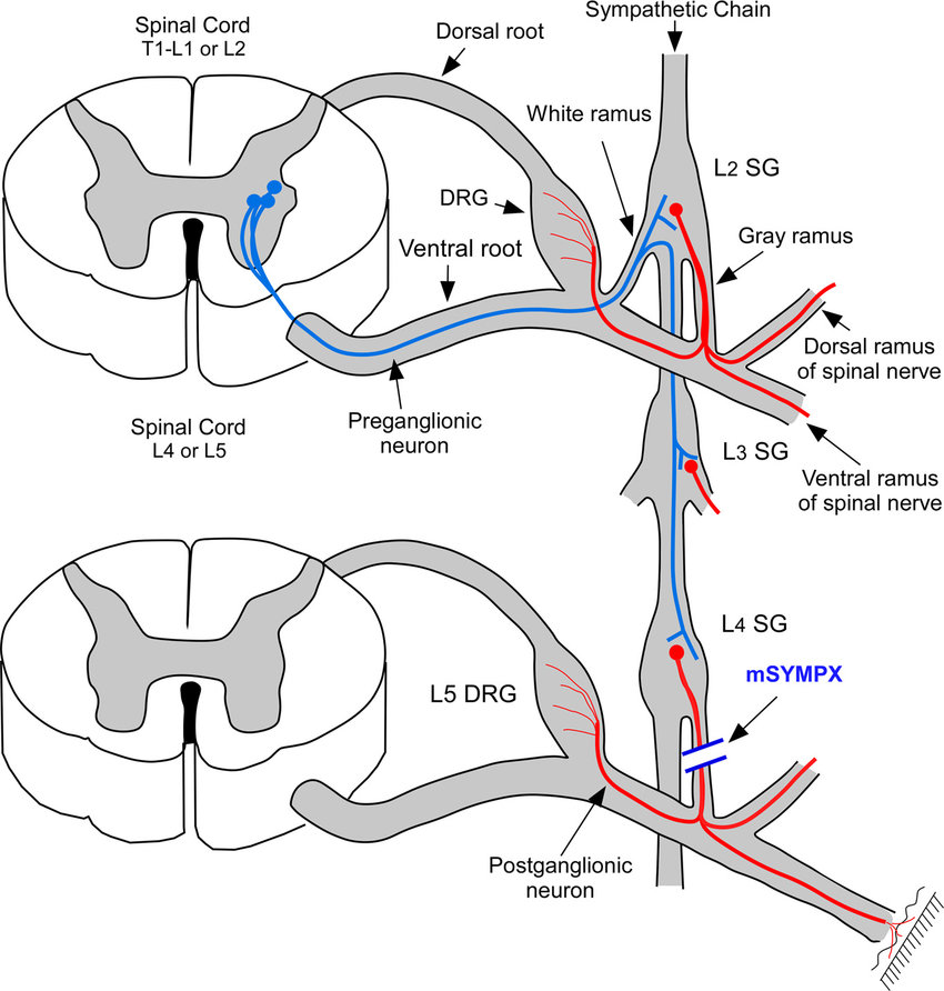 Diagram of mSYMPX... - Clinical Anatomy & Operative Surgery | Facebook