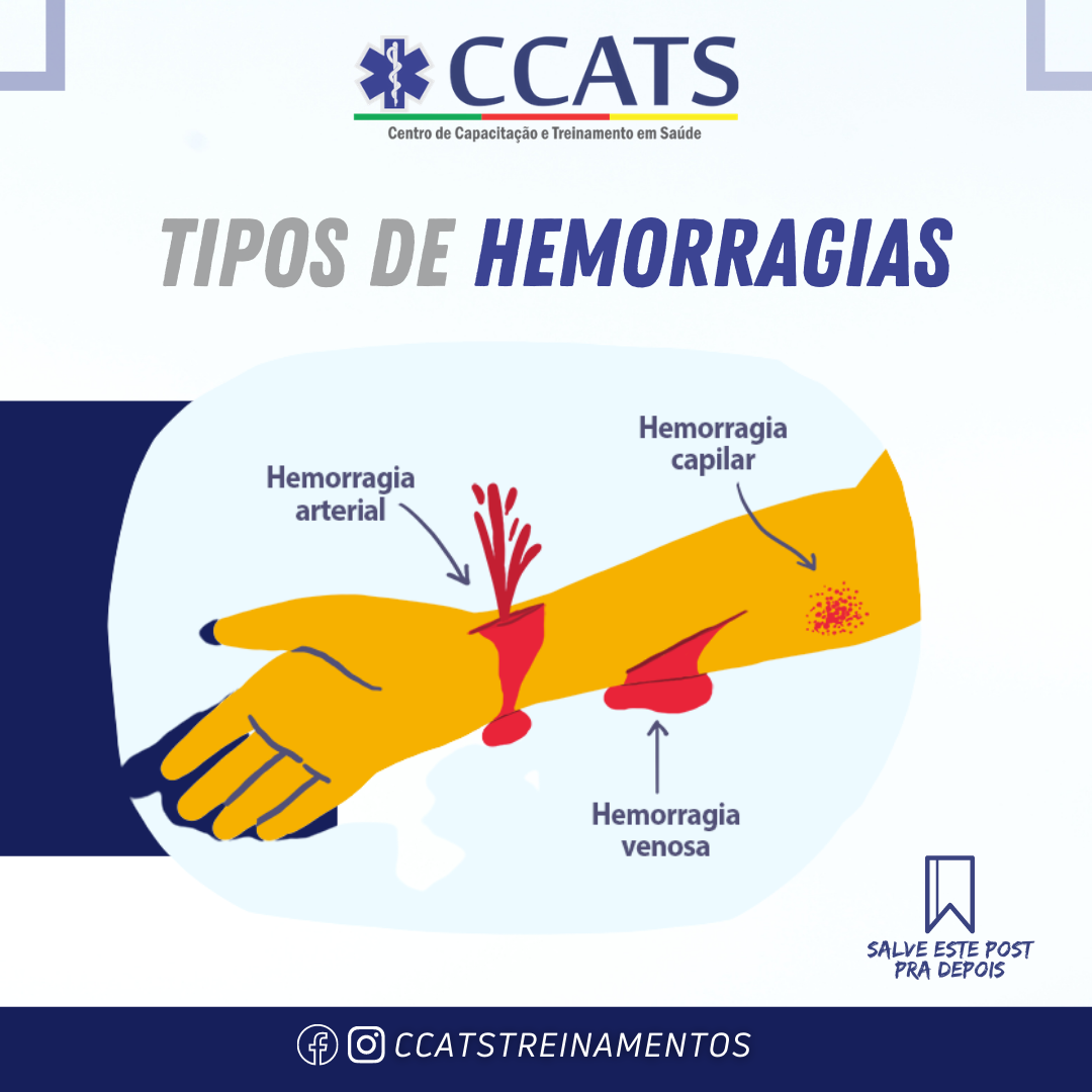 🩸Saiba mais sobre os tipos de... - CCATS TREINAMENTOS | Facebook