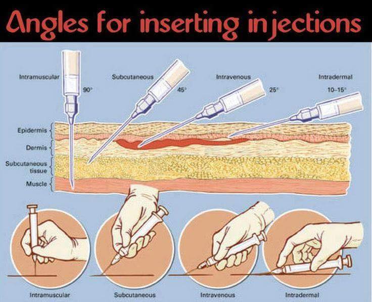 Angel Beauty Injection