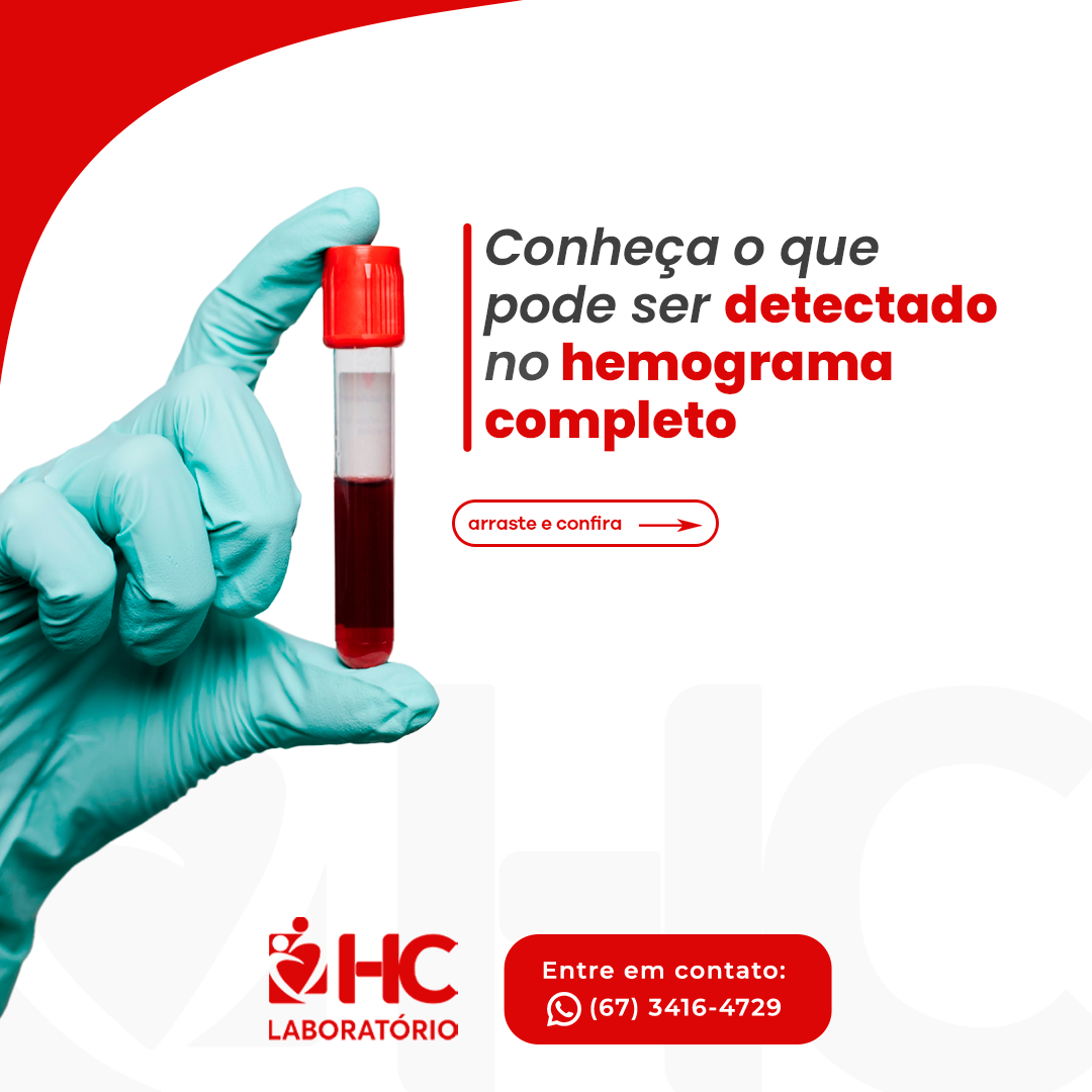 O hemograma completo, é um tipo... - Laboratório HC Dourados