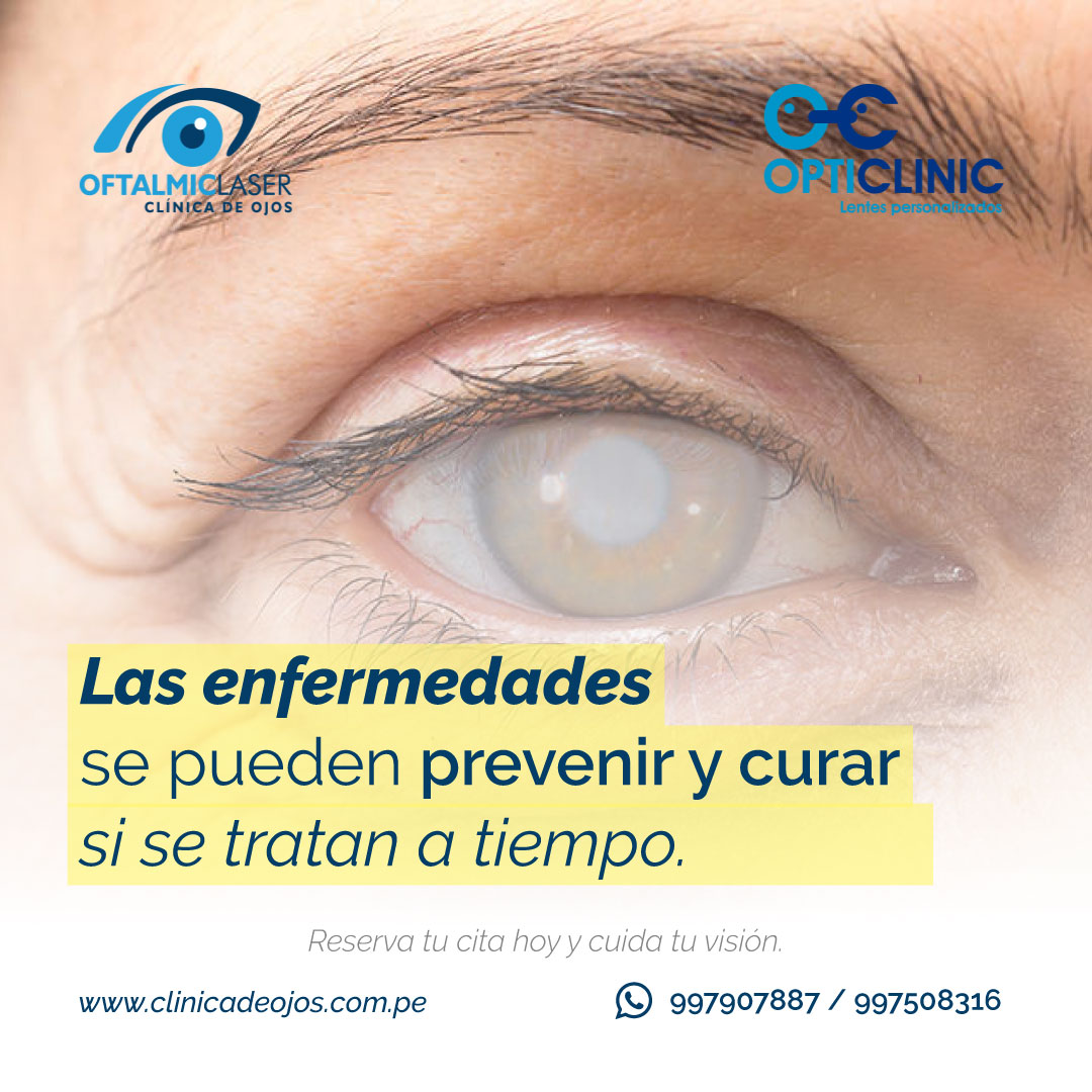 Clínica de Ojos Oftalmic Laser - No esperes a que sea demasiado tarde ...