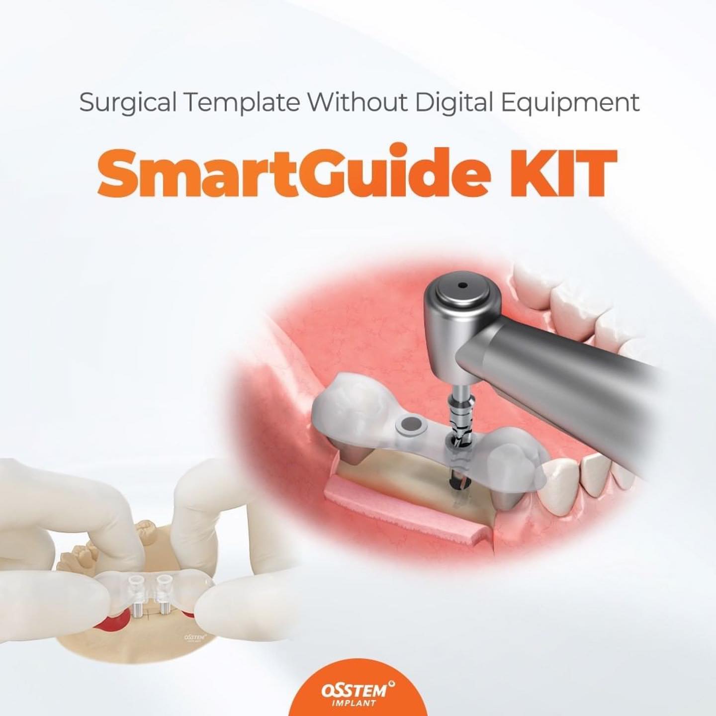 Osstem MEA - SmatGuide KIT allows you to easily make a... | Facebook