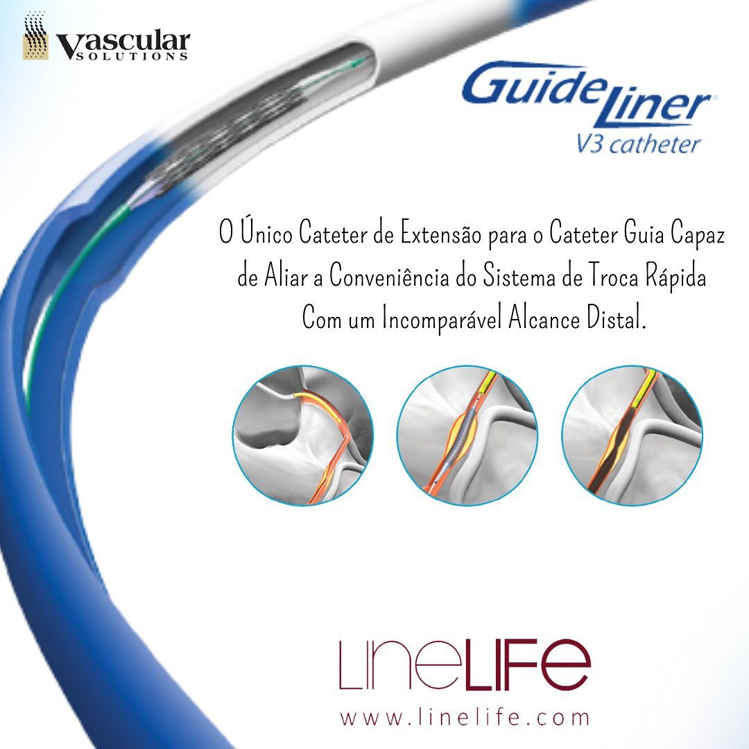 O GuideLiner é um cateter de... - Line Life Cardiovascular