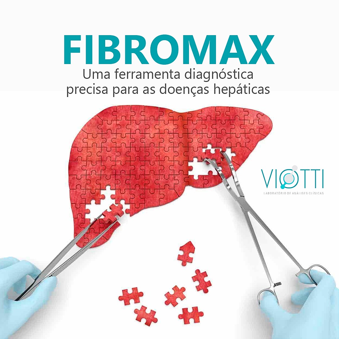 O Fibromax e uma... - Grupo Ribeiro - Medicina Diagnóstica