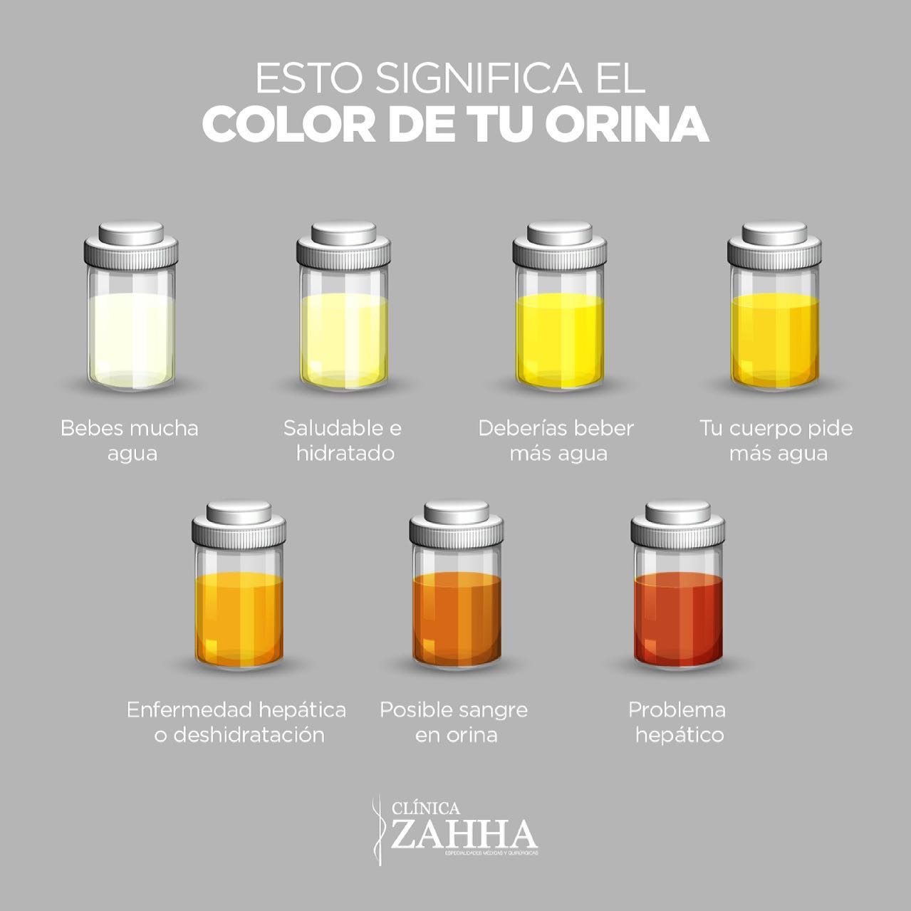 Clinica ZAHHA - El color de tu orina pueda revelar tu estado de salud ...