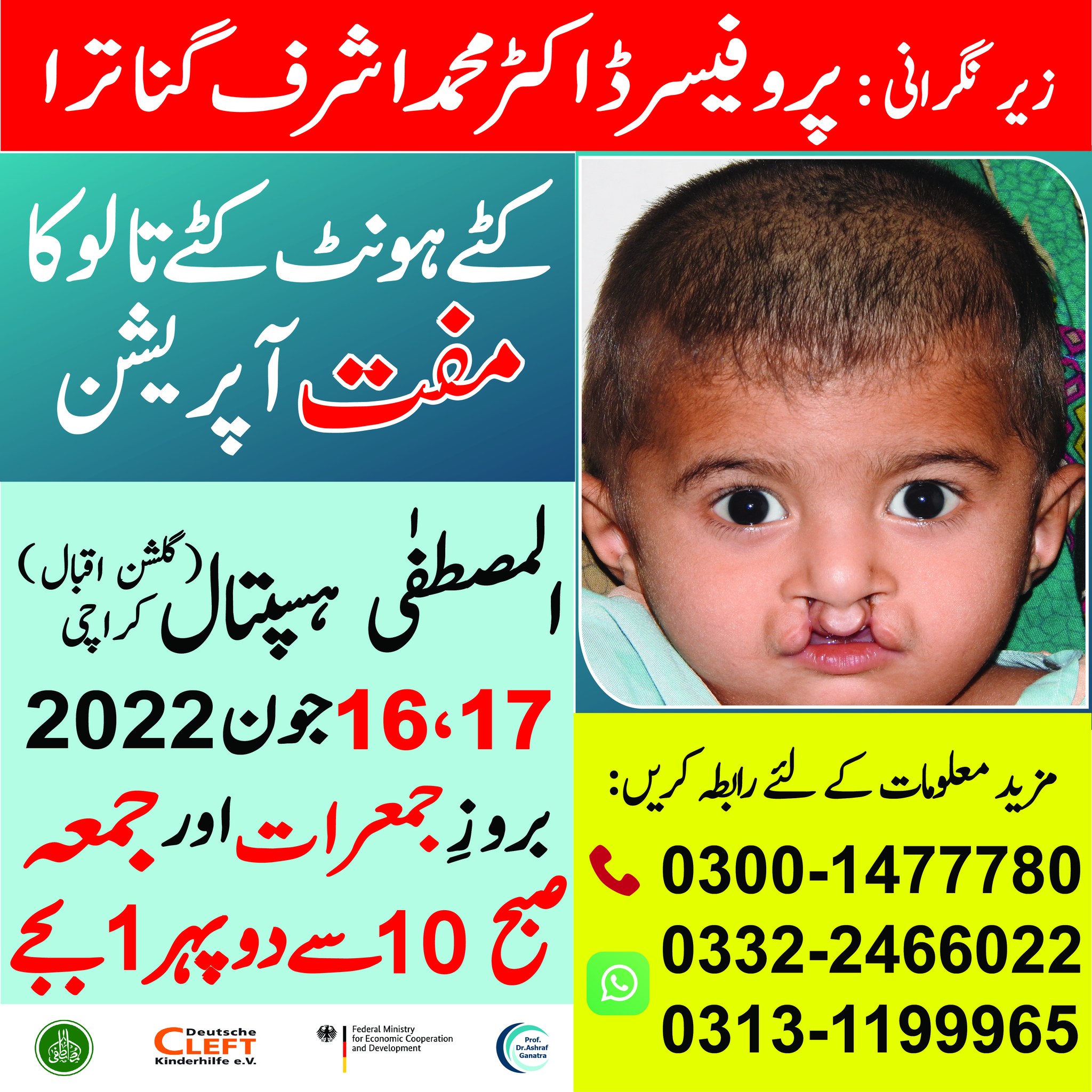 Cleft Pakistan - Free Cleft Lip and Cleft Palate Surgery... | Facebook