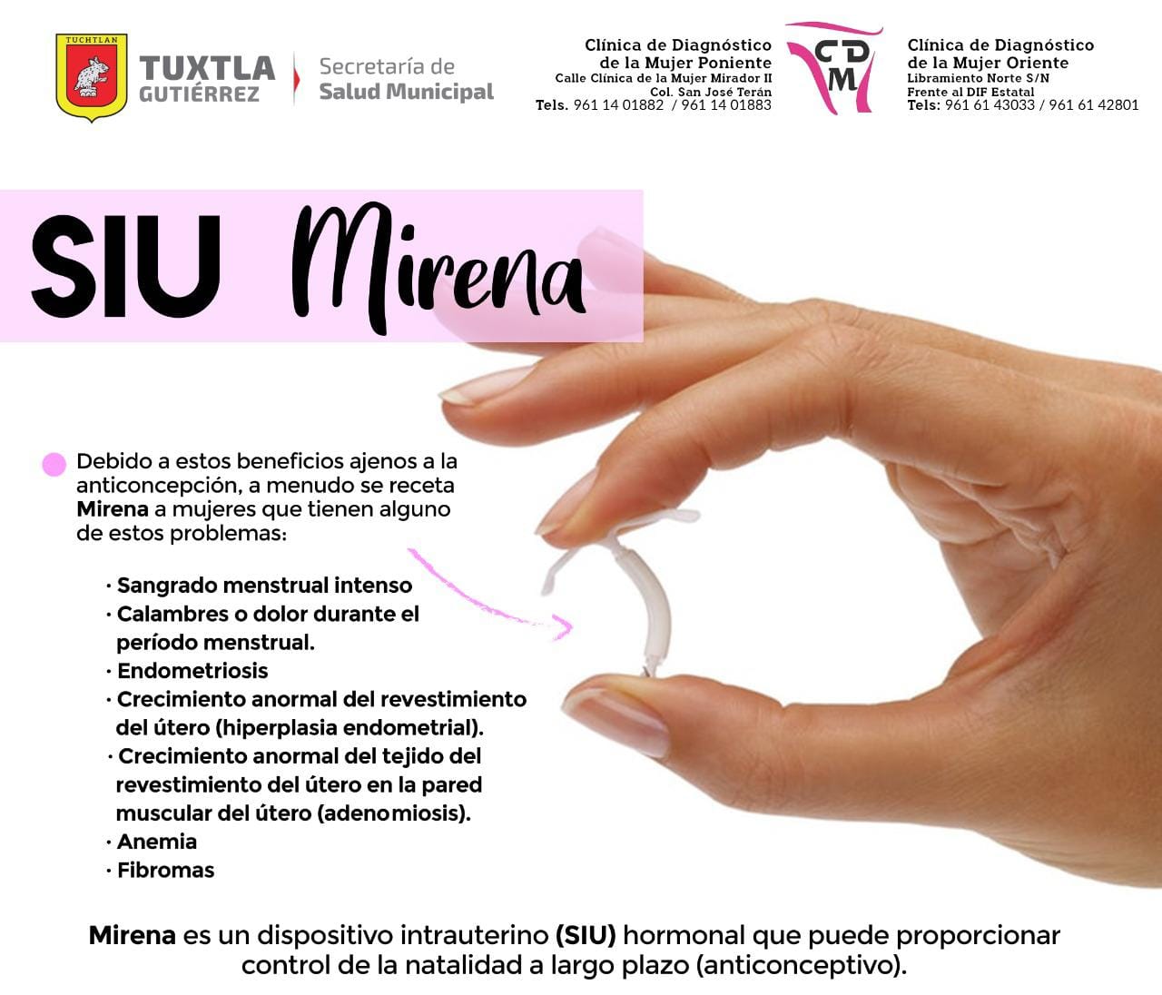 Conoce el SIU mirena - Visión Chiapas Magazine