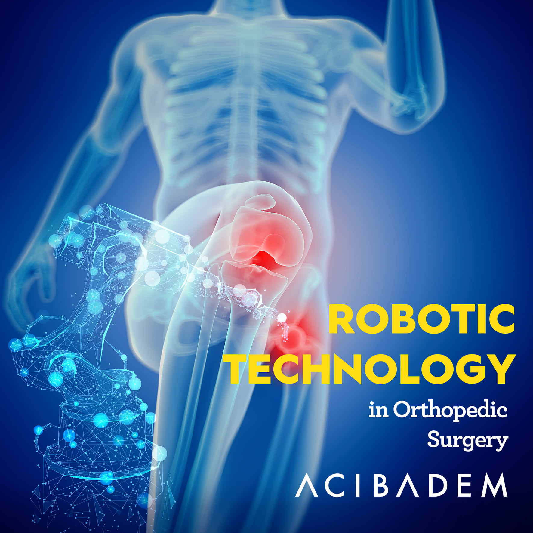 ACIBADEM Healthcare Services - Mako Rio Robotic-Arm system is used for ...