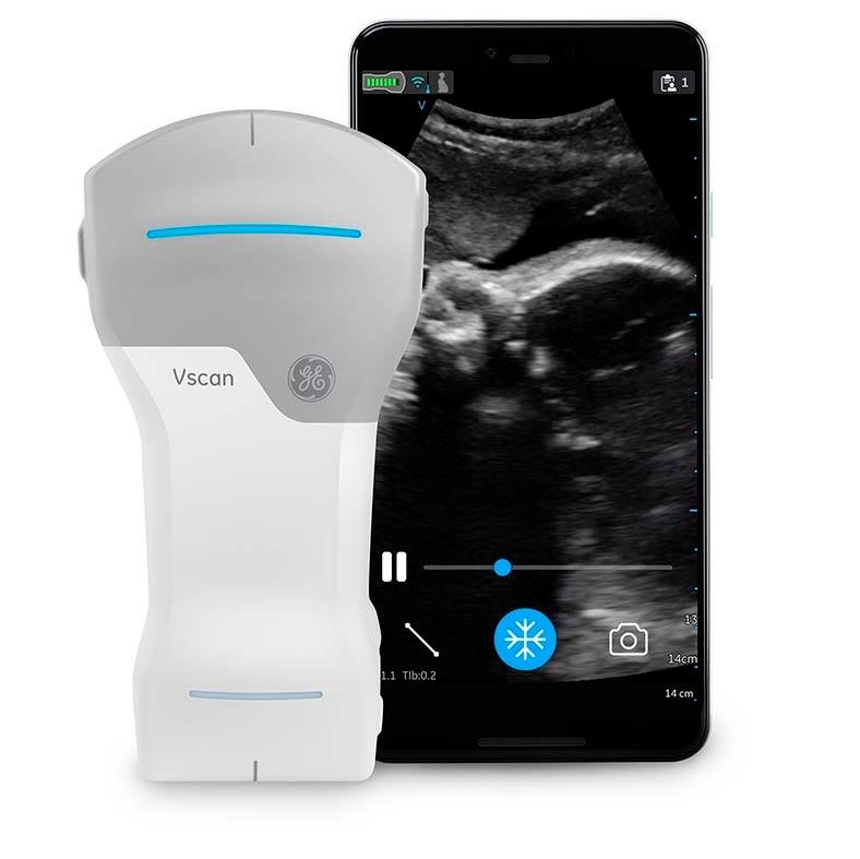 ASEAN POCUS - Handheld ultrasound devices are evolving technologically ...