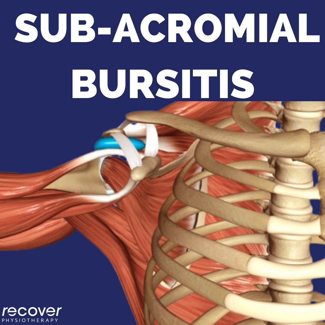 Recover - A bursa is a fluid filled sac that sits between tissues to ...
