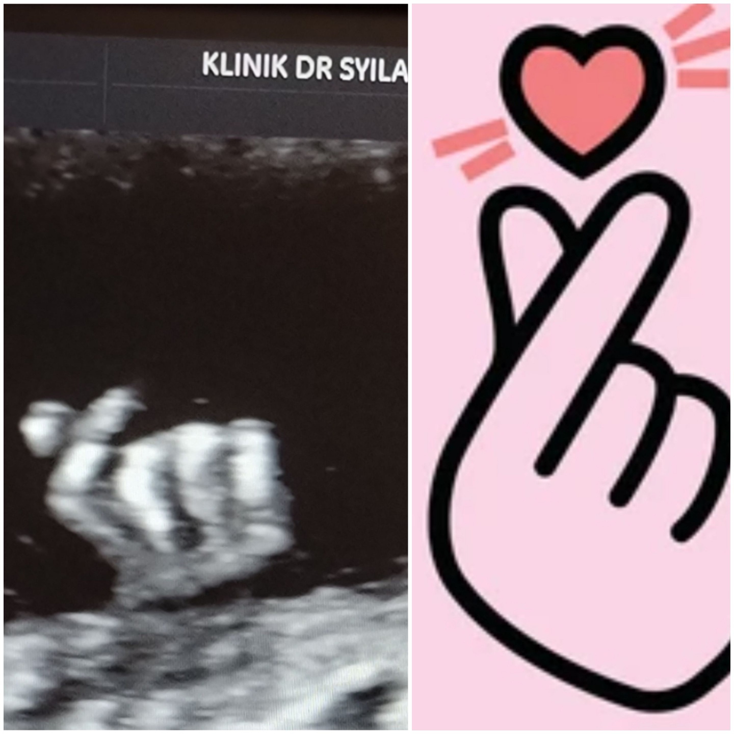 Klinik Dr Syila Kamunting Home Facebook