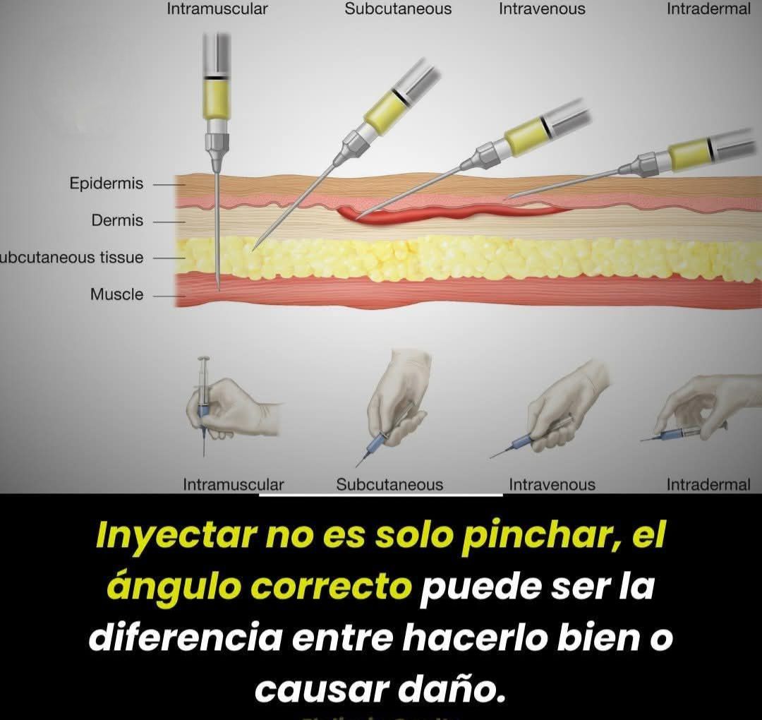 Aprende a Administrar Inyecciones Subcutáneas de Forma Segura! 💉 Las inyecciones subcutáneas son una forma segura y efectiva de administrar medicamentos como insulina o anticoagulantes directamente en el tejido graso, no en