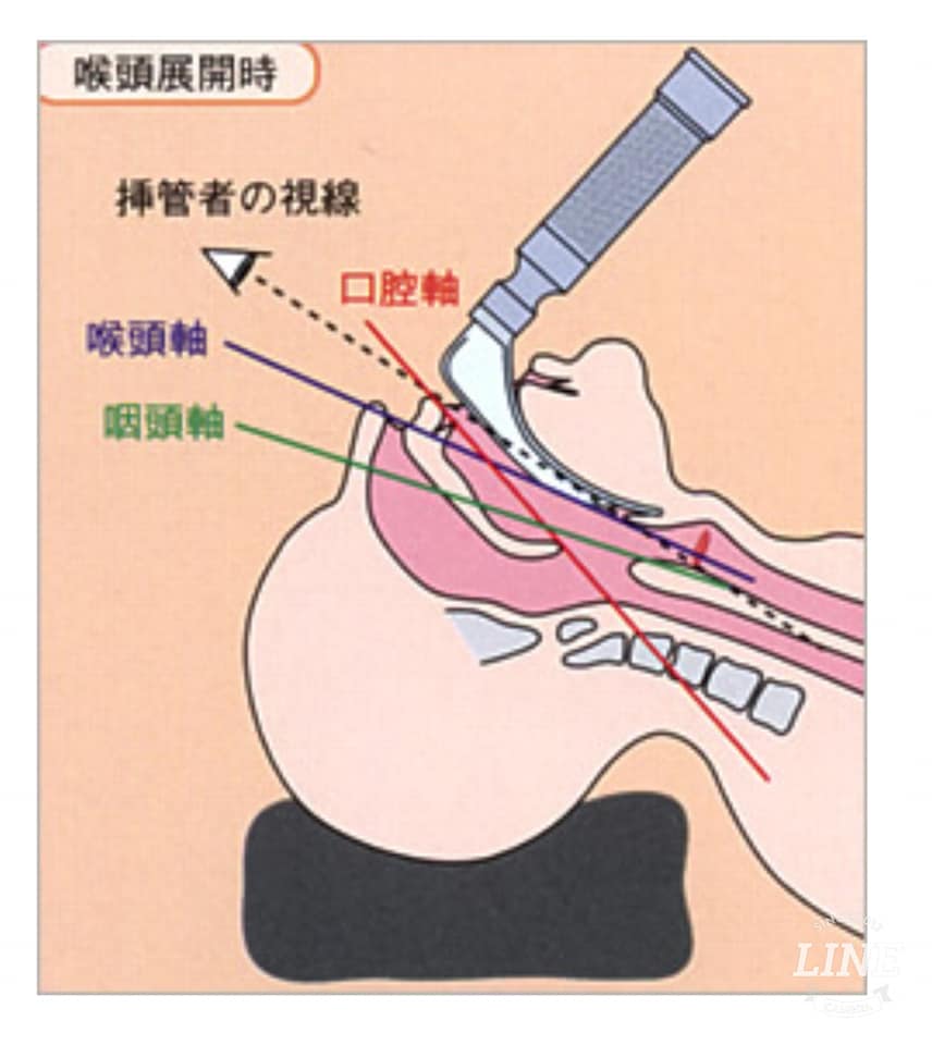 全身 麻酔 呼吸