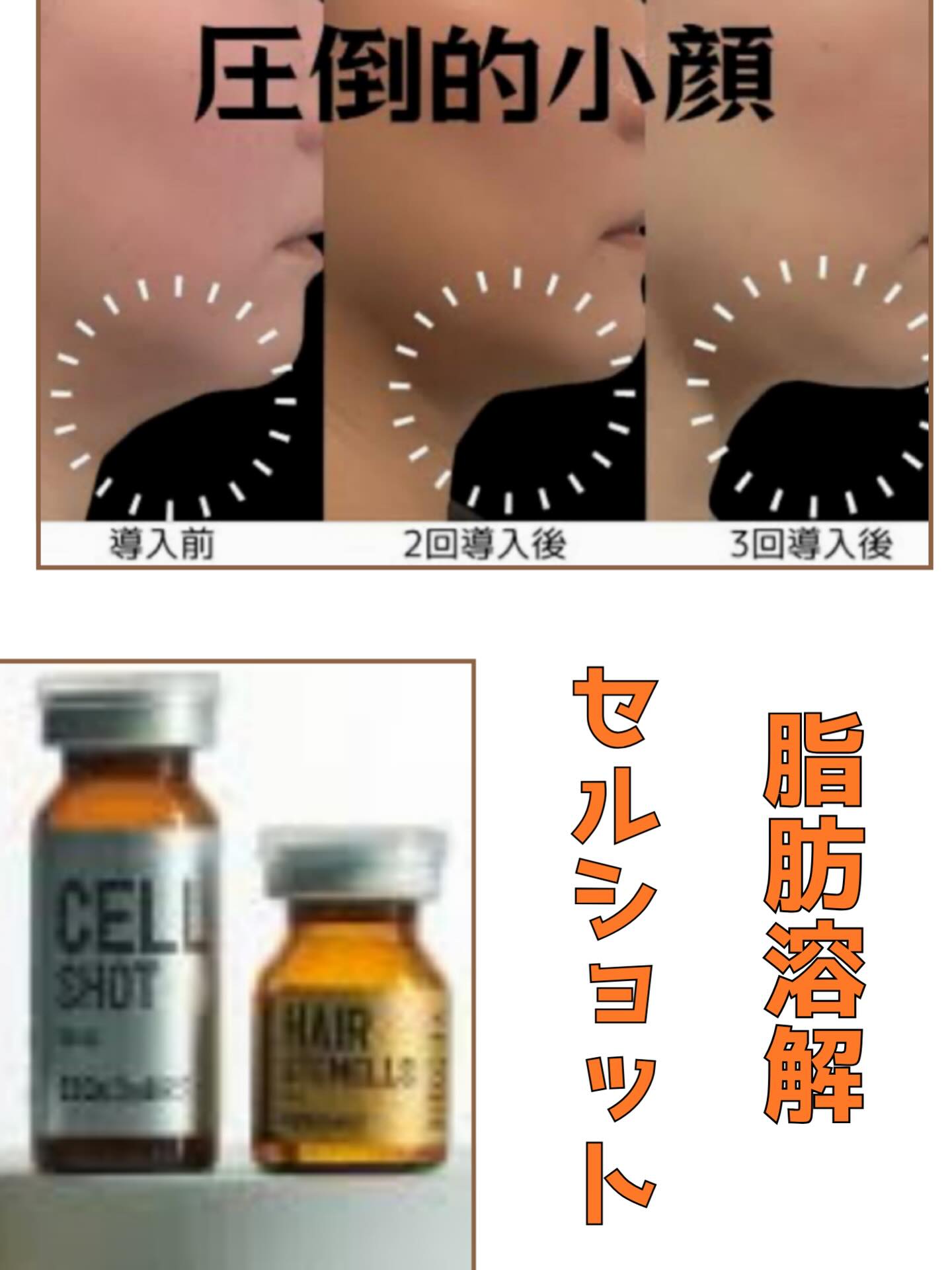 大人気すぎる🥰 脂肪溶解✨セルショット❣️ 本当に女心🩷 脂肪溶解