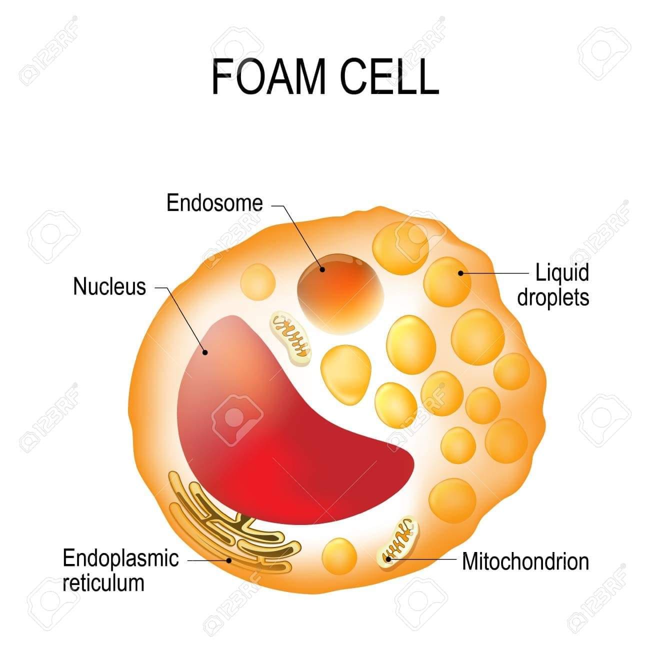 بايو بلال ماهي الخلايا الرغوية الخلية الرغوية Foam Cell هي خلايا مناعية دهنيه تنتمي الى نوع من الخلايا البلعميه تتكون هذه الخلايا من خلال عمليه التصلب العصيدي حيث
