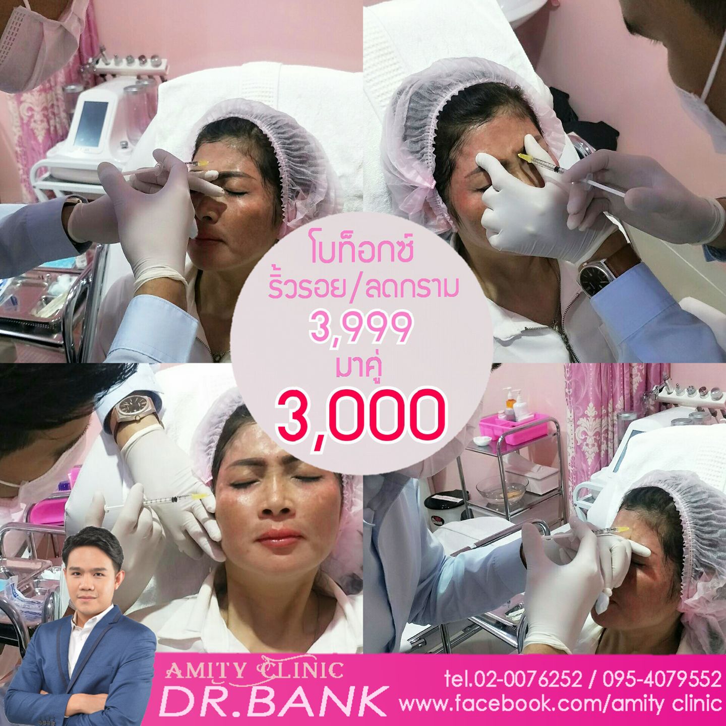 💉💉Botox buffet 💉💉 #โบท๊อกซ์... - The V-Sage Clinic
