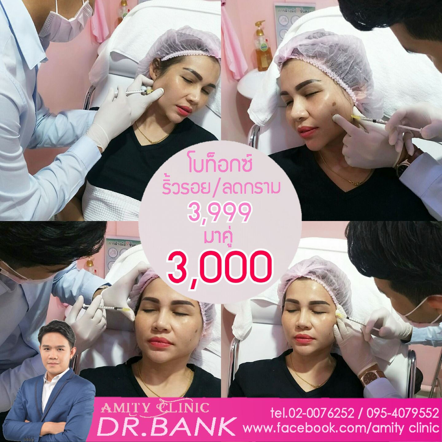💉💉Botox buffet 💉💉 #โบท๊อกซ์... - The V-Sage Clinic