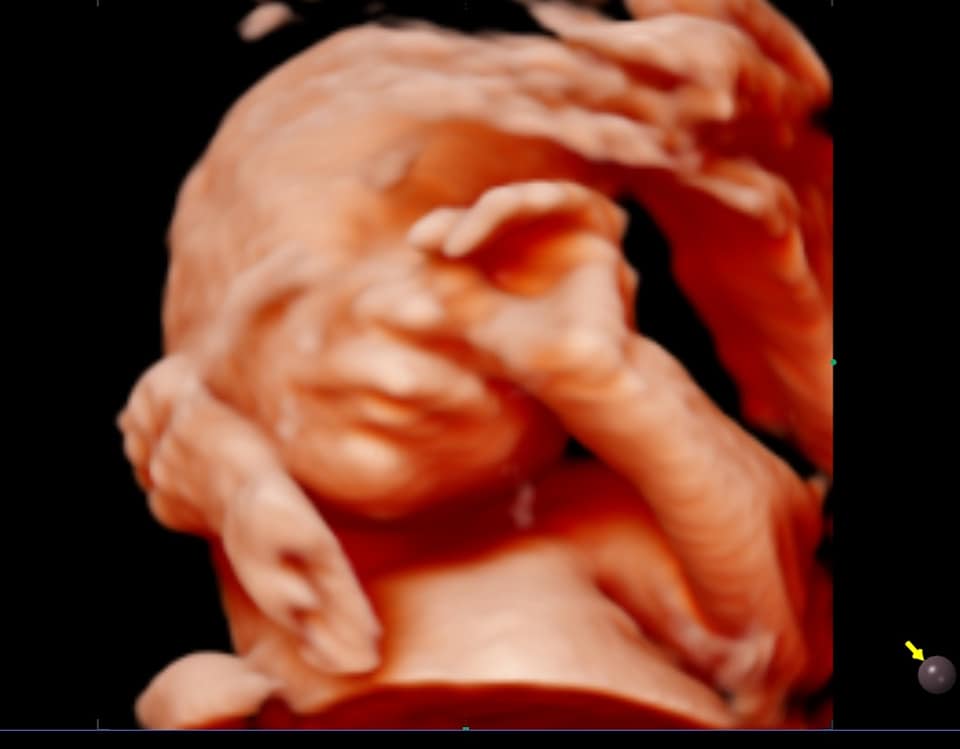Echographie 3d Bebe Art Echo Facebook