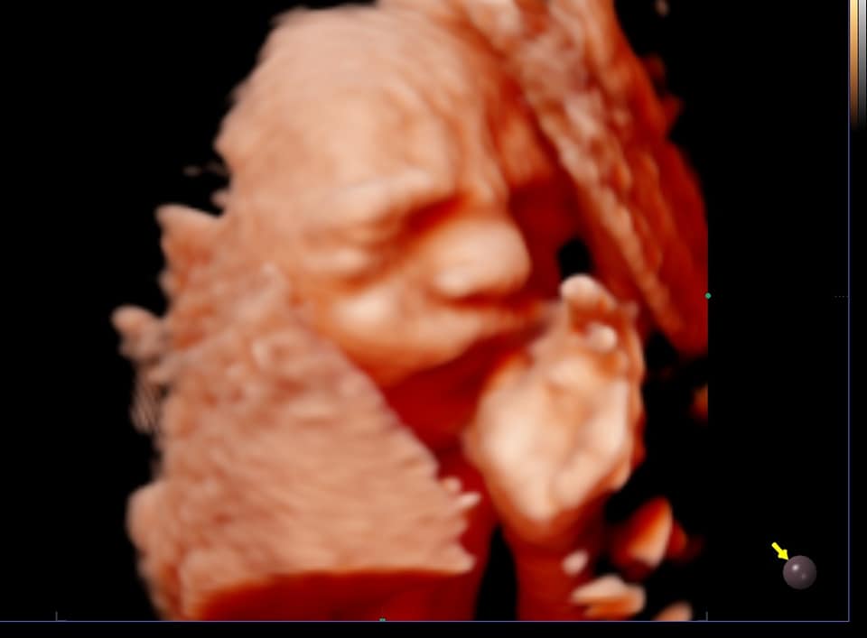 Echographie 3d Bebe Art Echo Facebook