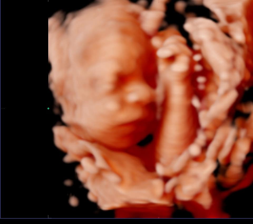 Echographie 3d Bebe Art Echo Pocetna Facebook