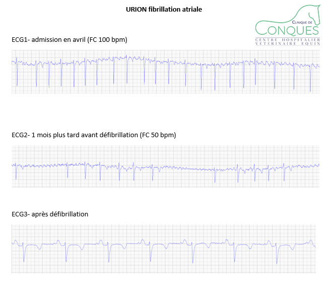 🩺 Myocardite et fibrillation atriale 🔹 URION a été présenté au mois d ...