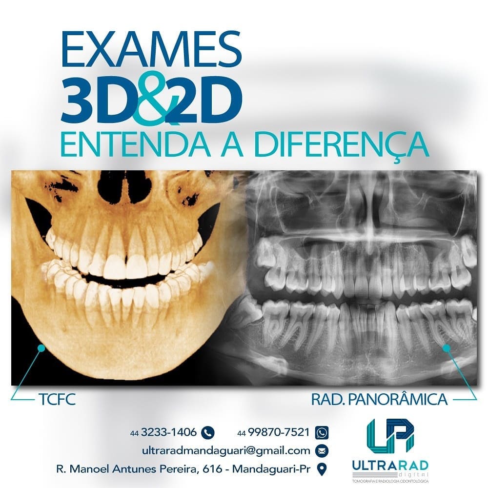 🗣️... - Ultrarad - Radiologia Odontológica Digital