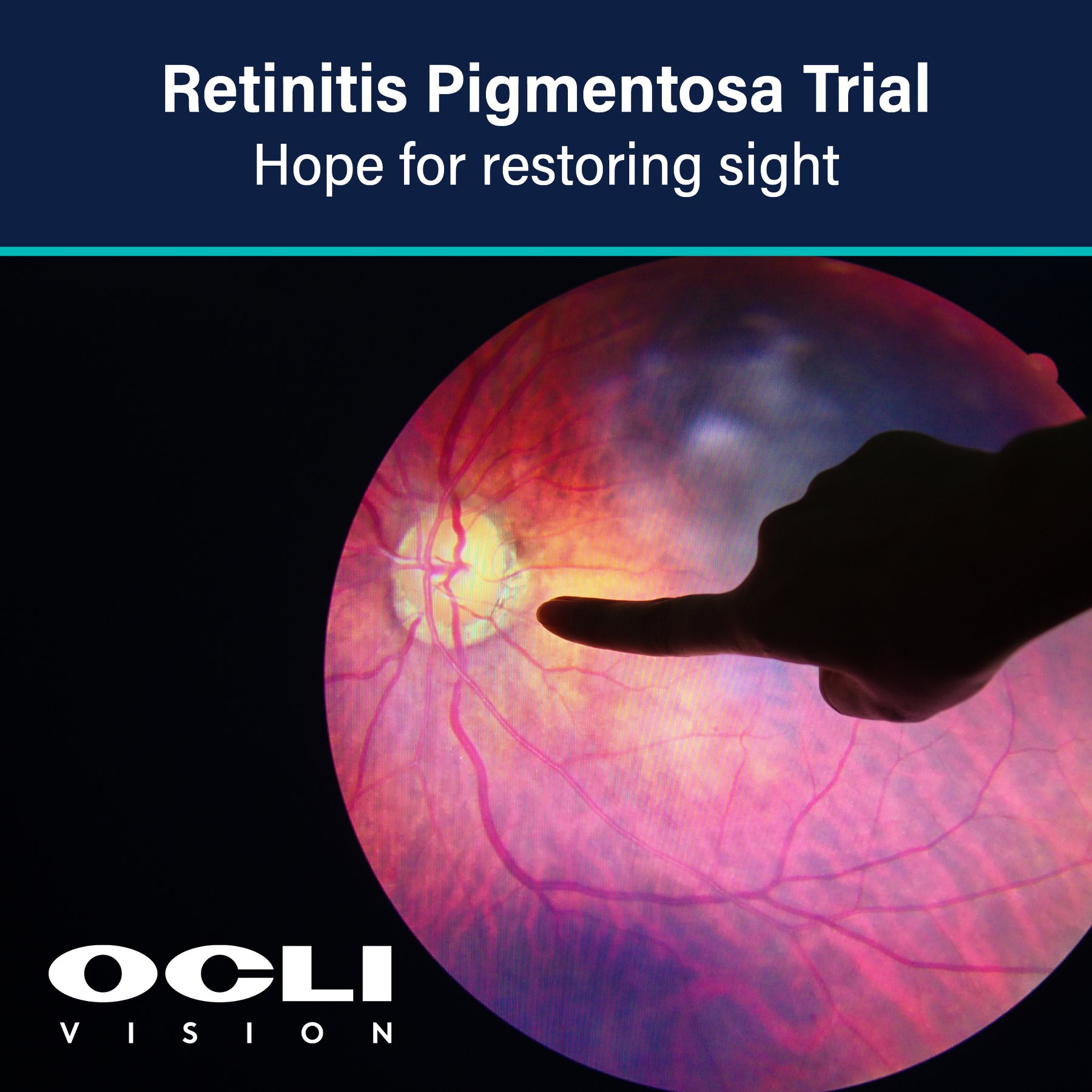 OCLI Vision - We’re proud to announce new technology is... | Facebook
