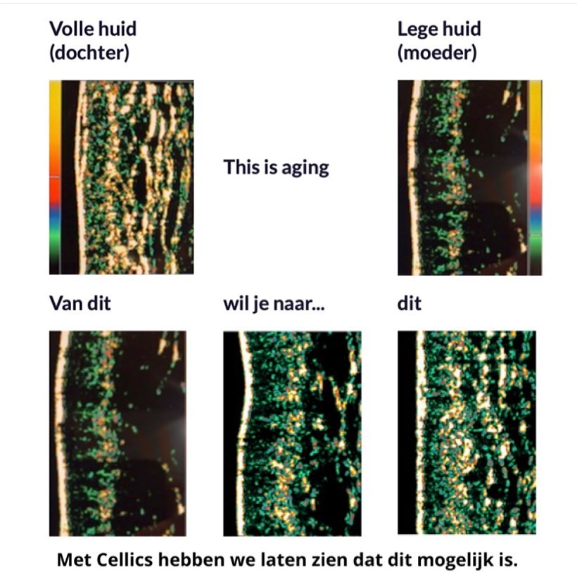 Huid & Laser Praktijk Ninette de Wit - 
