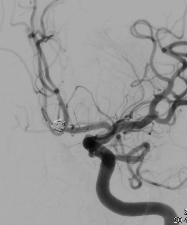 Srinivasan... - Srinivasan Paramasivam - Hybrid Neurosurgeon