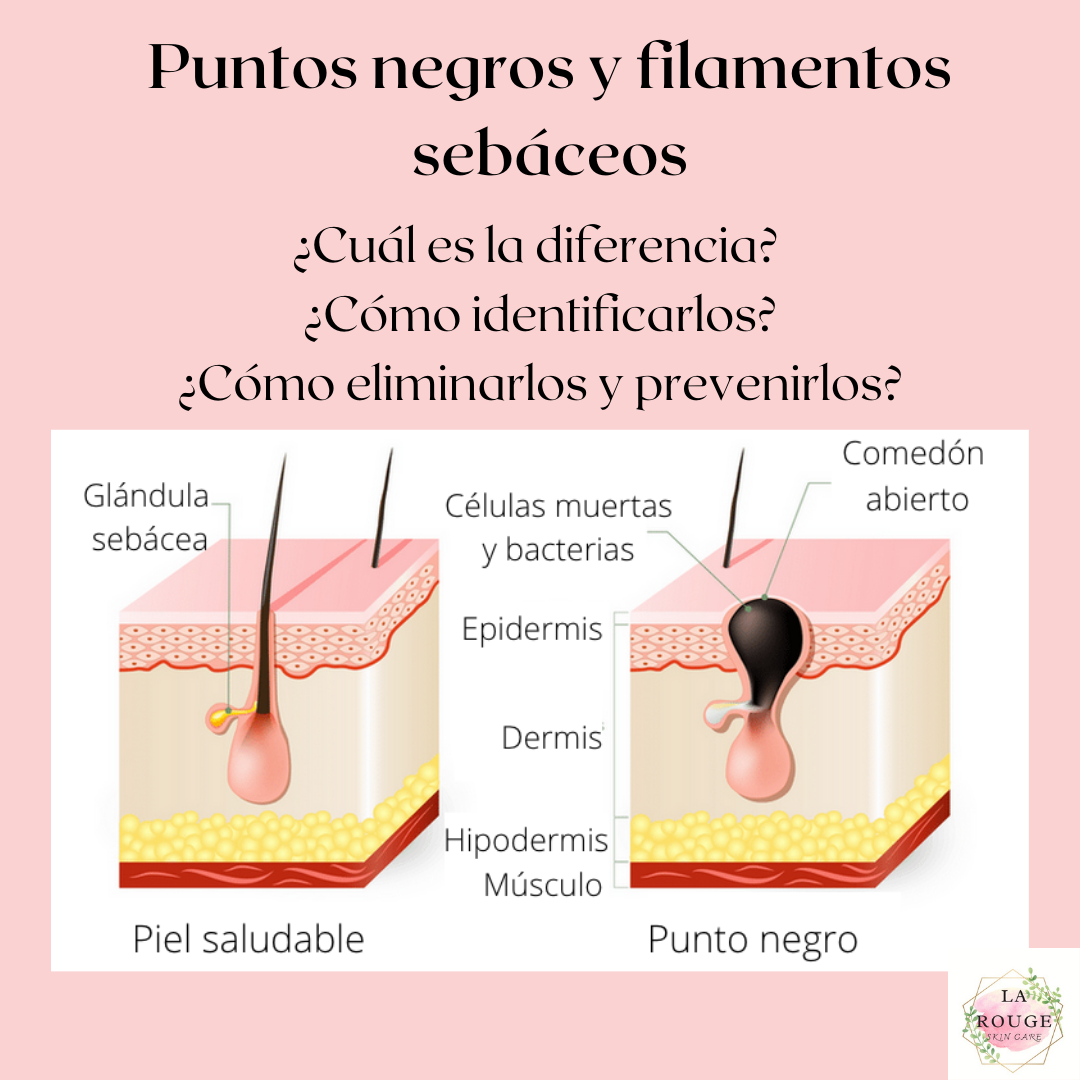 Los puntos negros y los filamentos... - La Rouge. Skincare