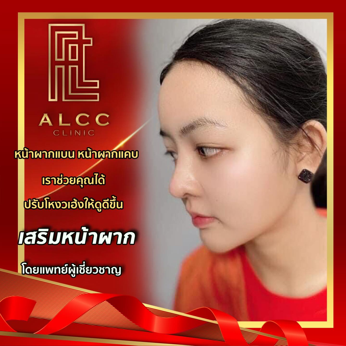 ALCC Clinic - อวดหน้าผากใหม่ หวานละมุน โค้งมนได้รูปสุดๆ 😍... | Facebook