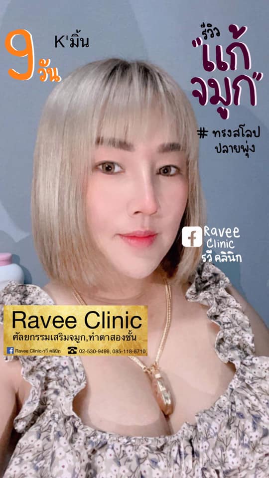 แก้จมูก👃🏻