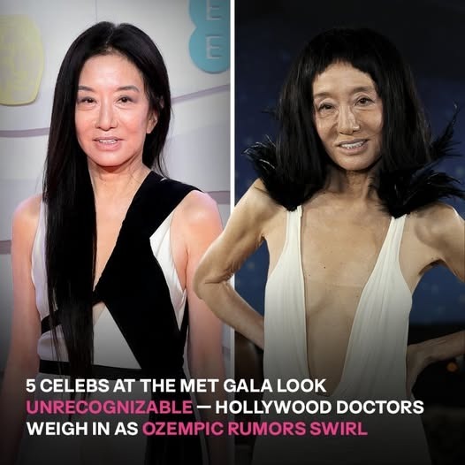 Hollywood doctors investigate which Met Gala 2025 stars may have used Ozempic. 👀