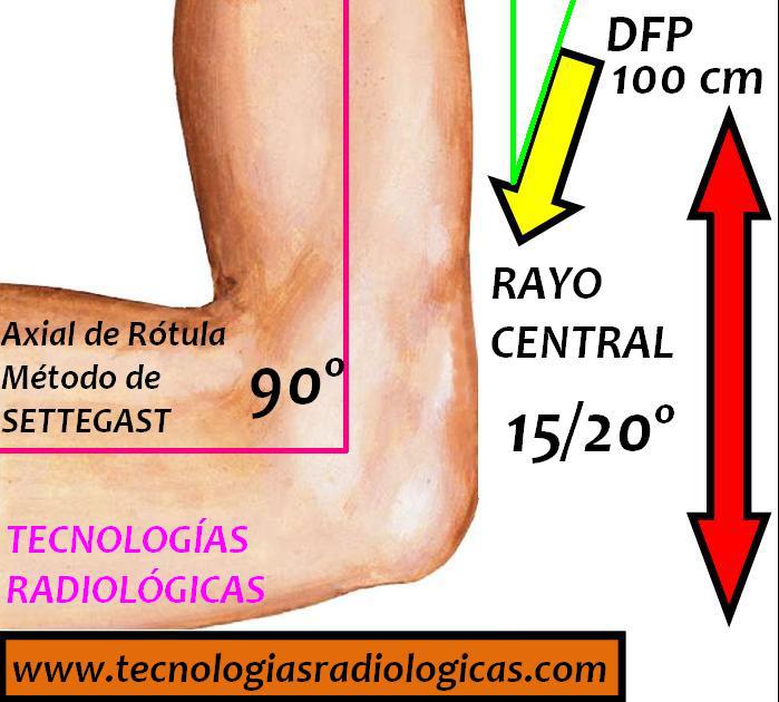 Tecnologías Radiológicas - RÓTULA (método de Settegast) Proyección ...