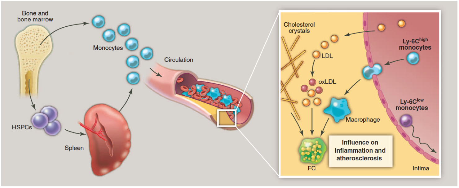 Systemic inflammatory networks in ischemic heart disease