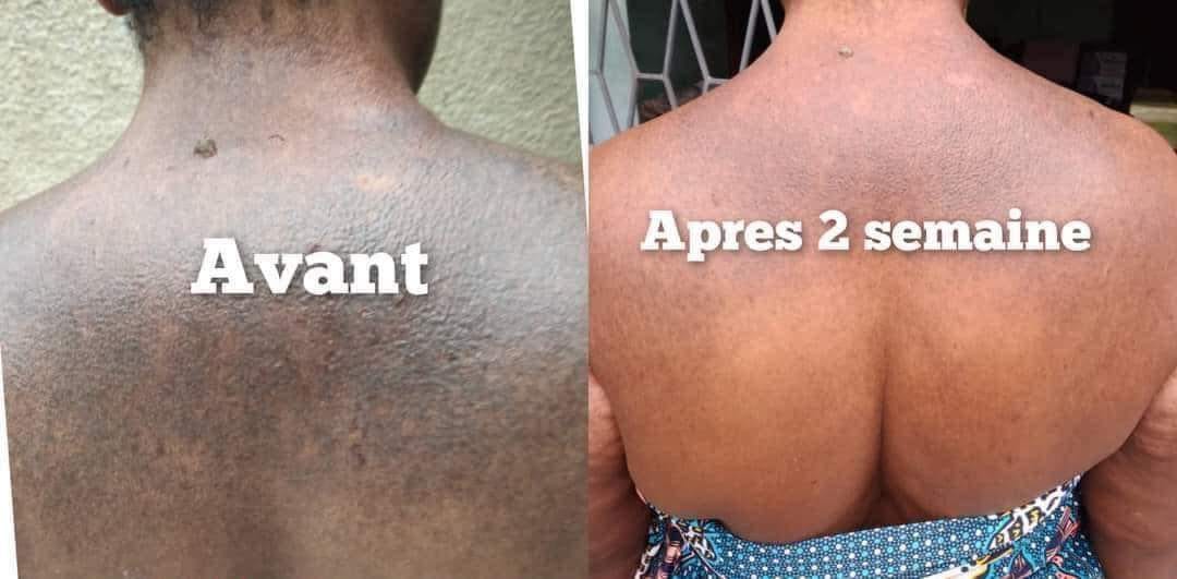 Savon Éclaircissant Intense MOLATO - Visage Et Corps - Résultat En 5 Jours - SPF50 - Neuf