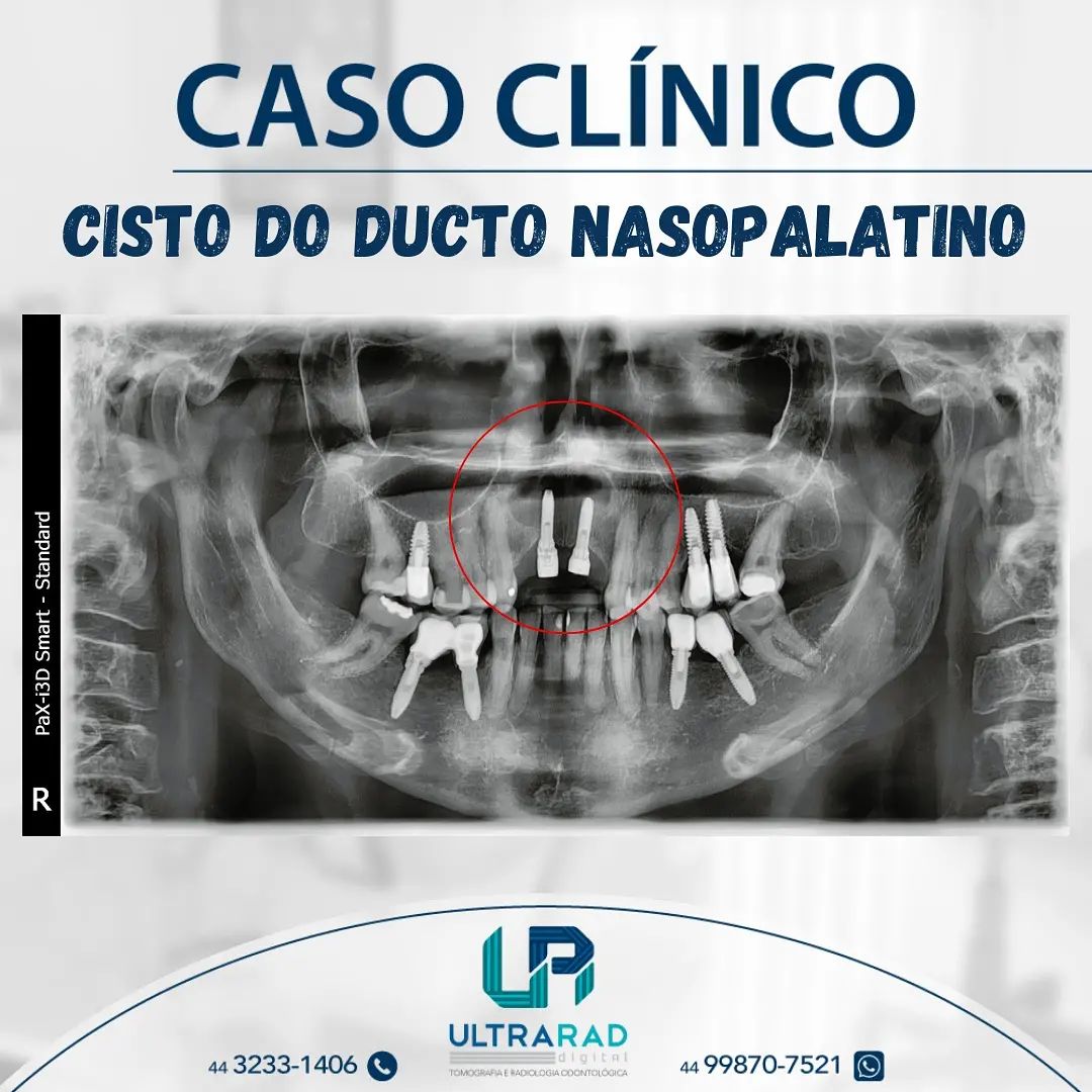 💀CASO CLÍNICO... - Ultrarad - Radiologia Odontológica Digital