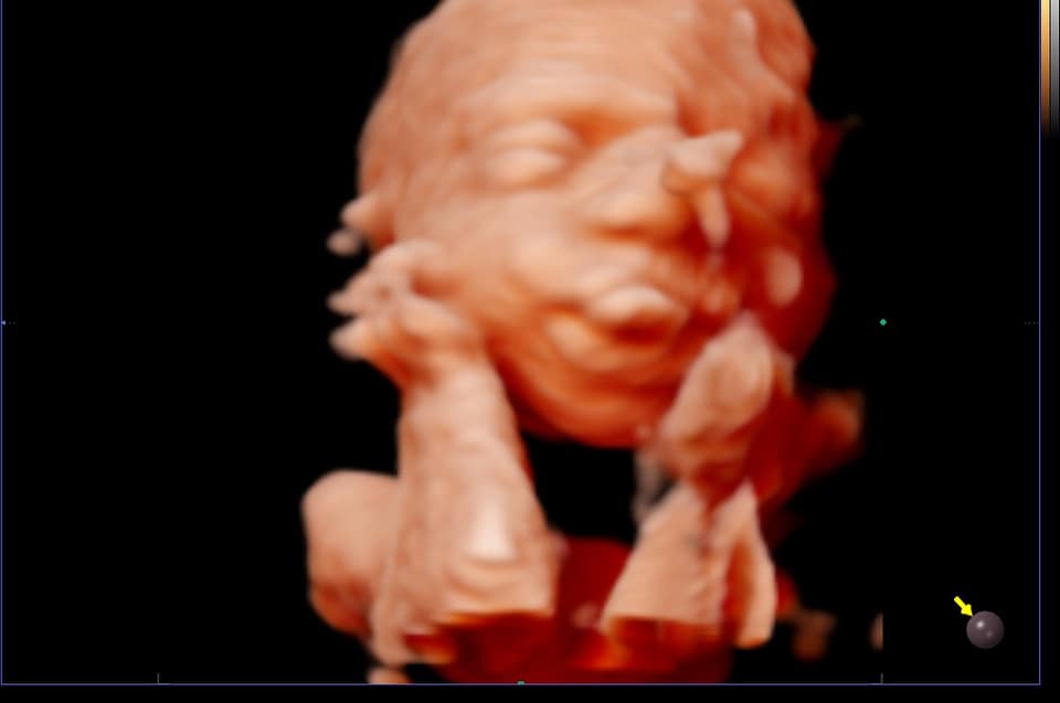 Echographie 3d Bebe Art Echo Facebook