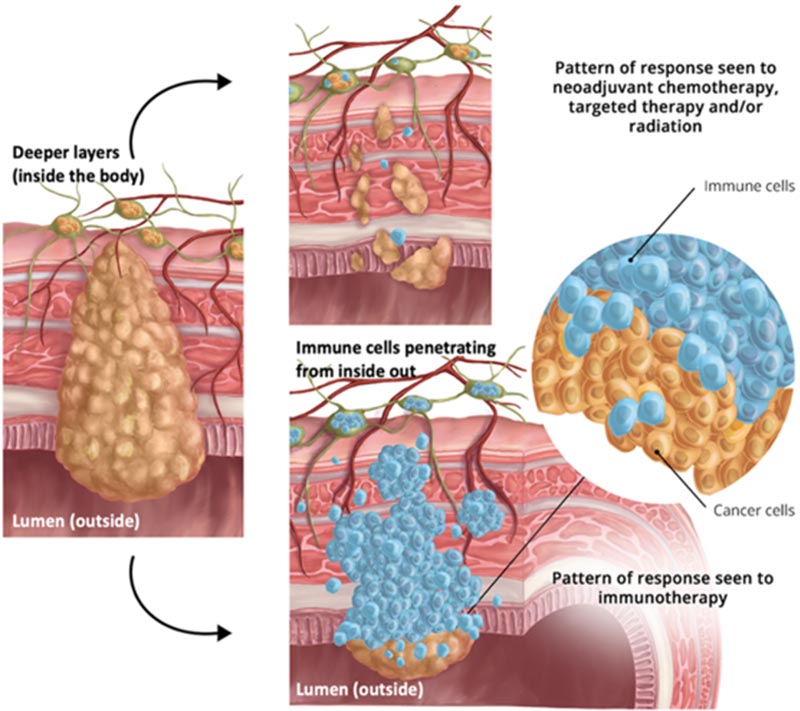 Medicine news | **[https://www.nyp.org/advances/article/ongoing ...