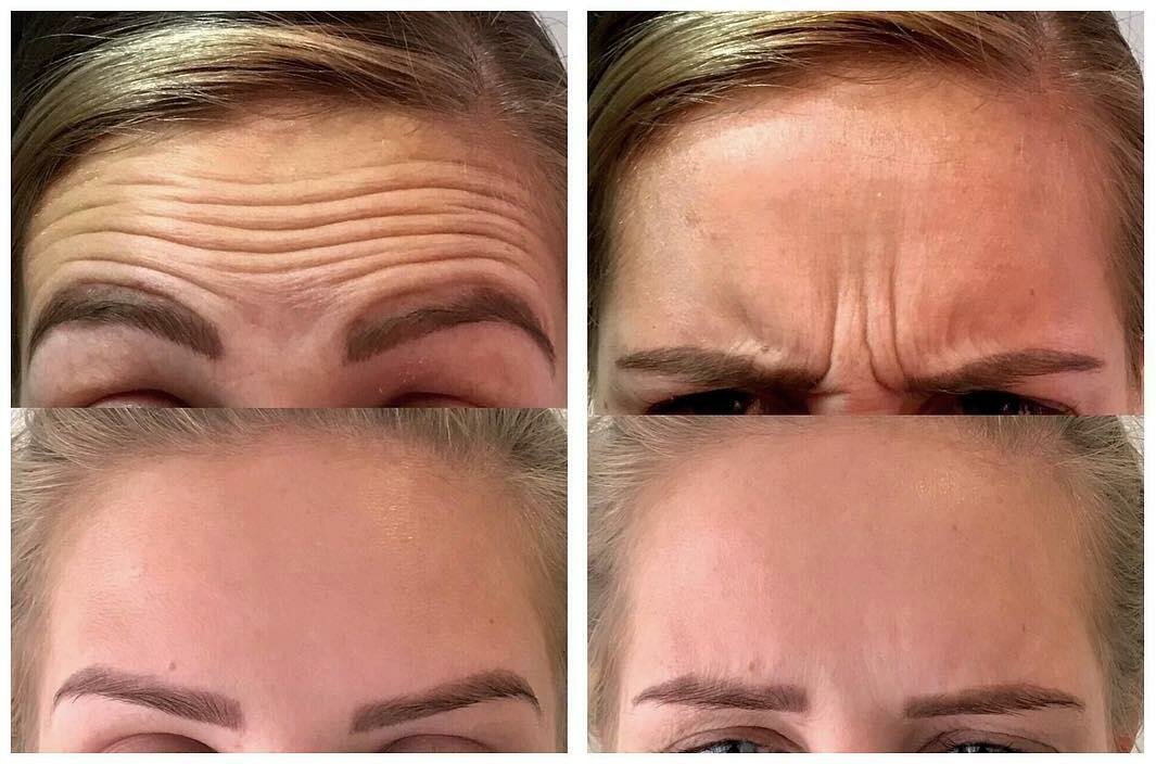 أسئلة تتعاود برشة في... - Dr. Nejmeddine Chemli Dermatologue | Facebook