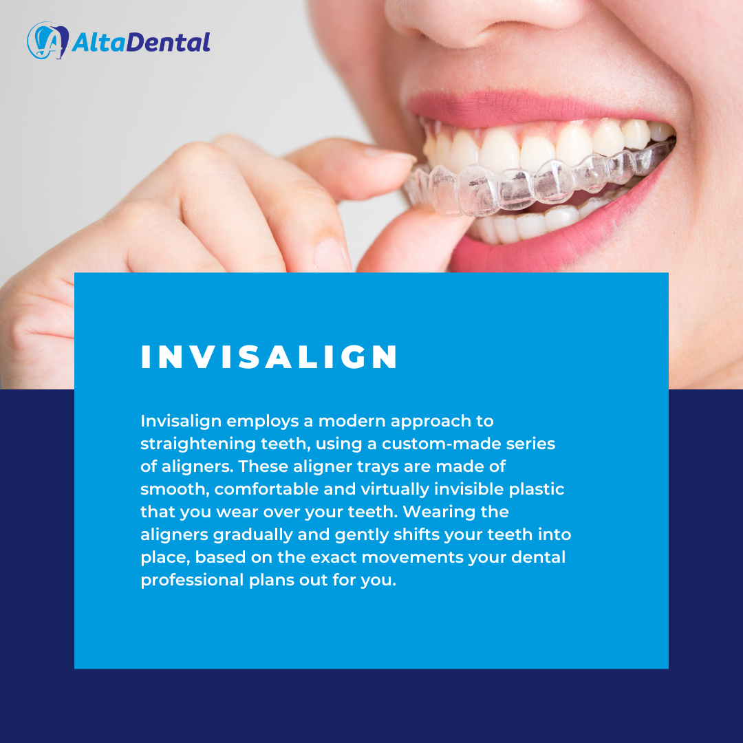 The advantage and appeal of the... - Alta Dental Chicago