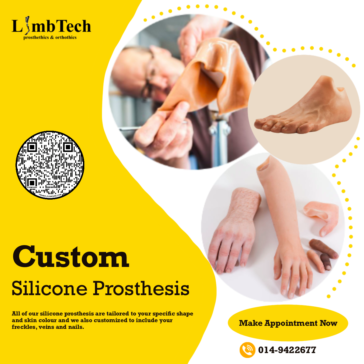 Limbtech Prostheticsorthotics Membuat Kaki Palsu Halaman Utama Facebook