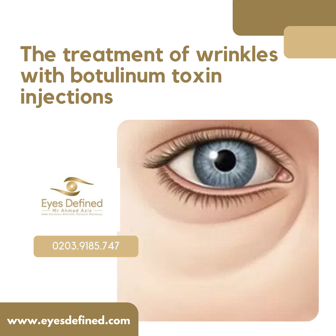 Mr Ahmad Aziz - What is botox used for? Botulinum toxin...