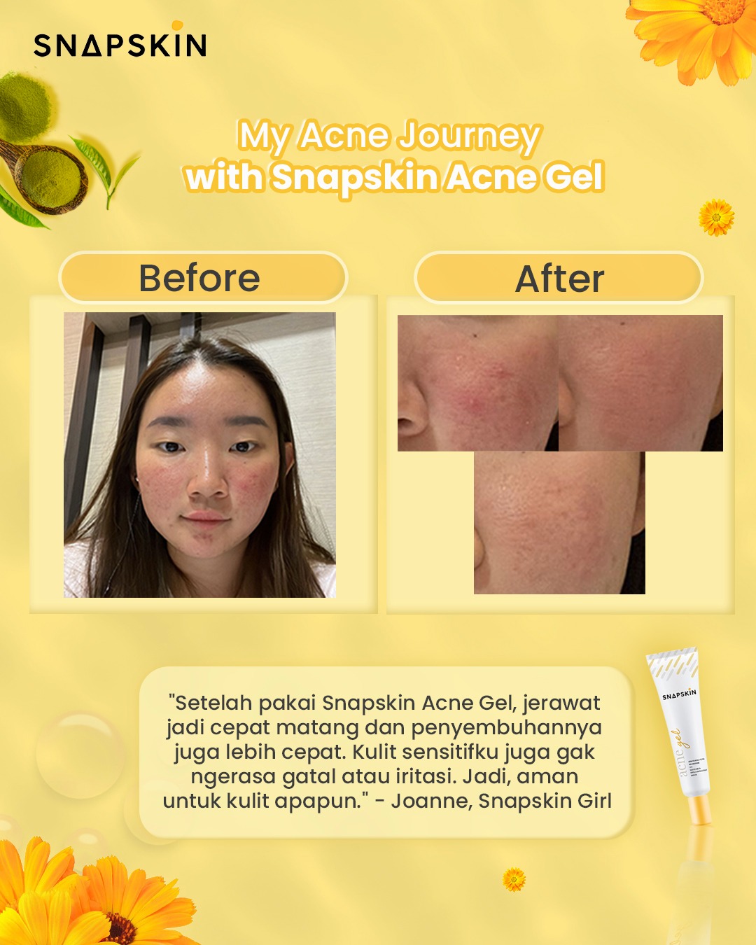 snapskinid - AMAN BUAT KULIT SENSITIF Hi, perkenalkan...