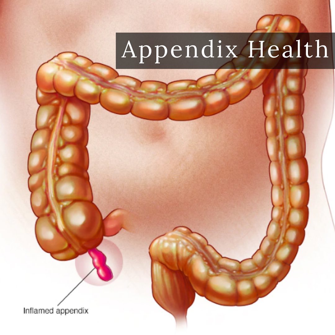 The appendix is a small, tube-shaped... - Dr Fathima Docrat