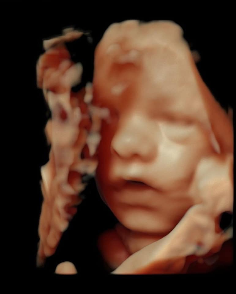 Groupe De La Tele Realite Les Marseillais Les Anges La Villa Etc Stephanie Devoile Le Visage De Son Bebe En Echographie 3d Facebook